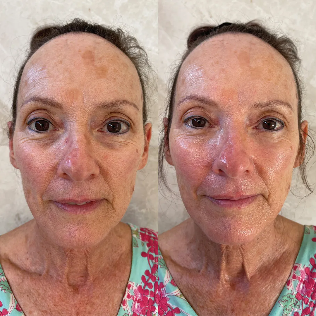 Hydration Skin System