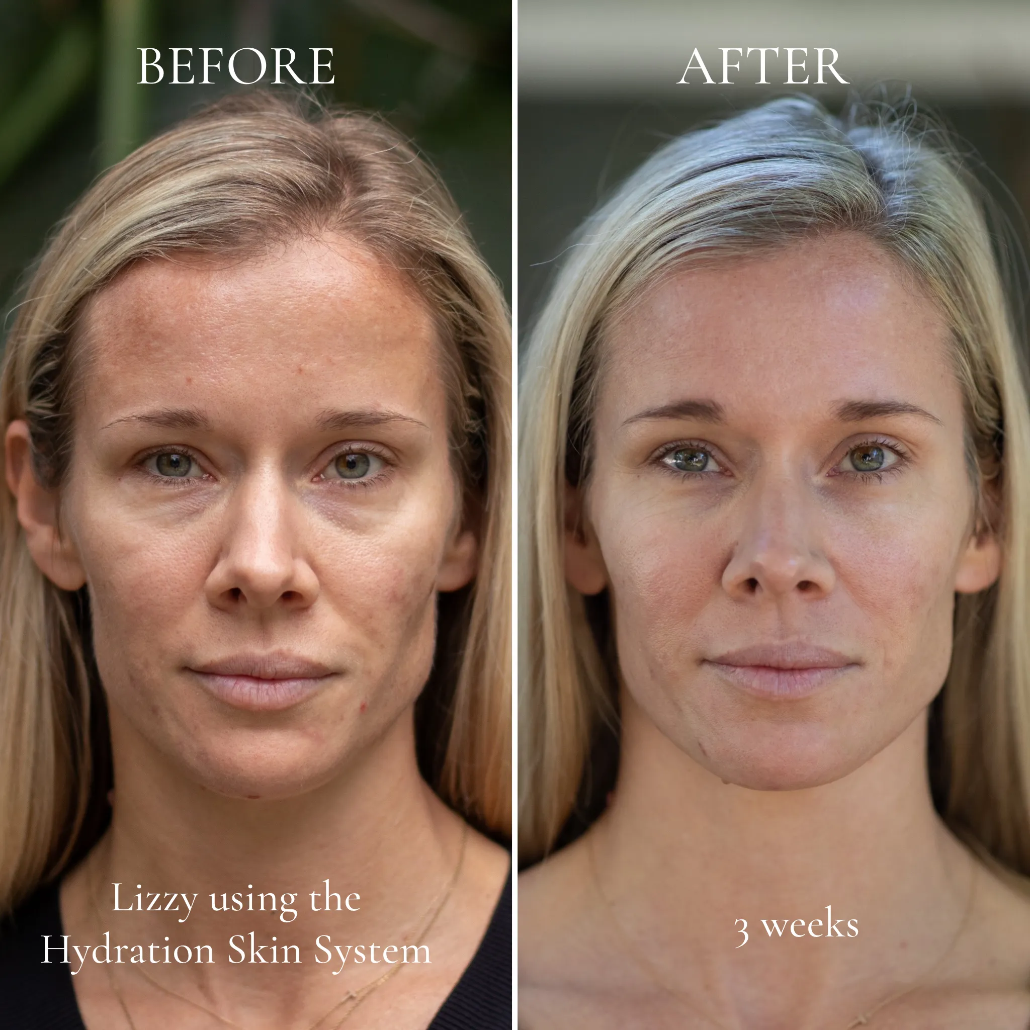 Hydration Skin System